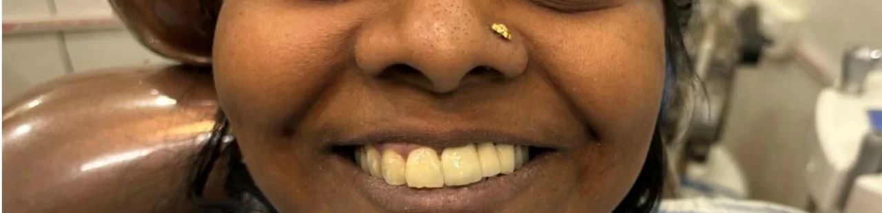 Patient case 1 after treatment at S & I Dental Clinic