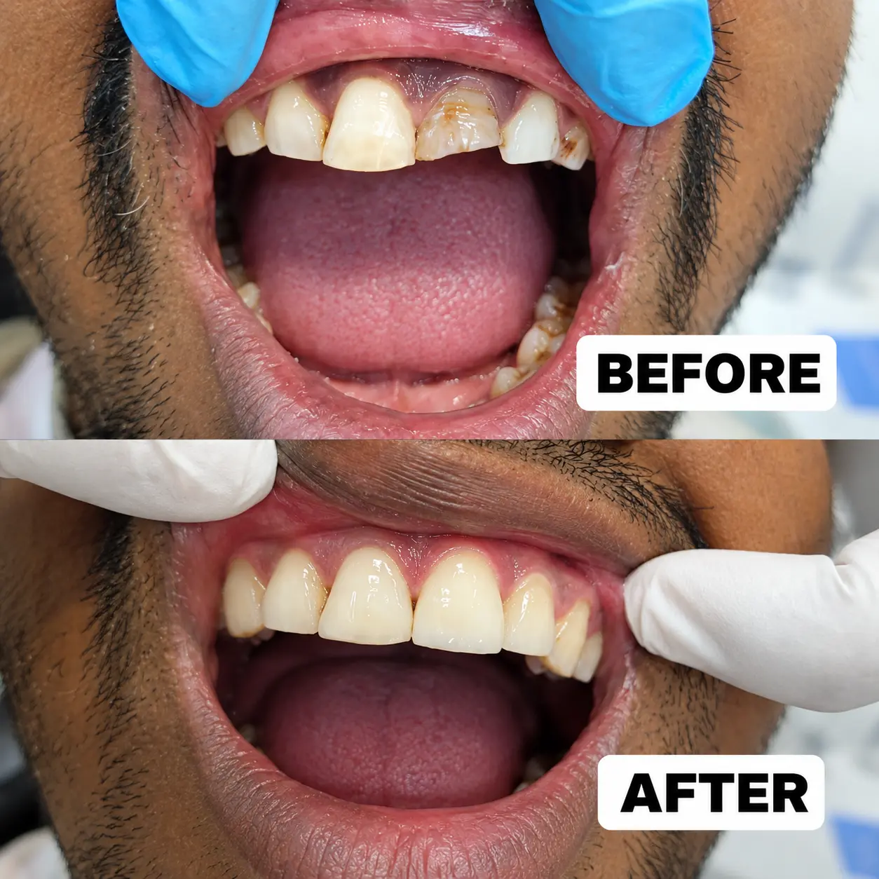 Before & After Cosmetic Dentistry at S & I Dental Clinic